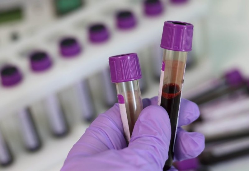 Coleta de sangue poderá ajudar no diagnóstico da doença de Alzheimer em um futuro próximo – Foto: Pixabay