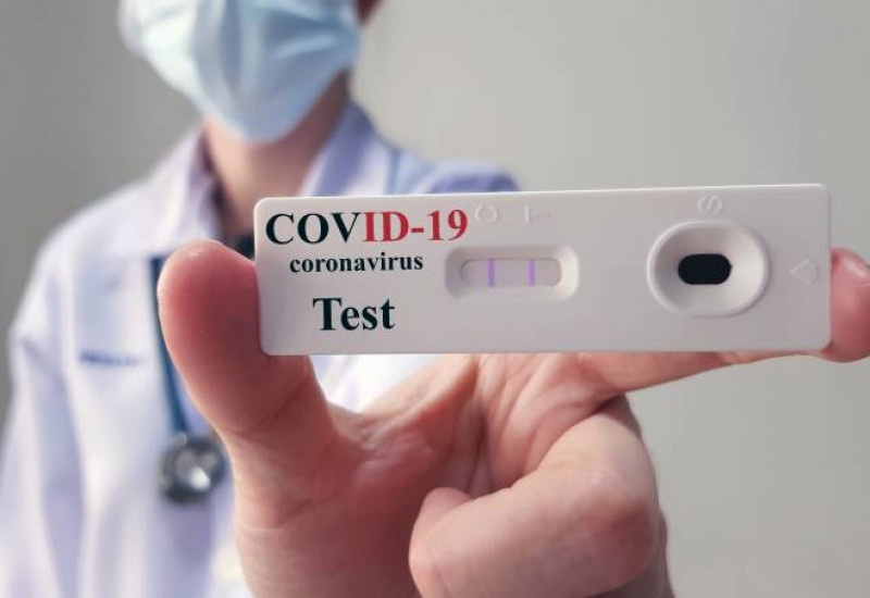 O grande número de testagem tem contribuído para diminuição dos casos de coronavírus em São Miguel do Oeste