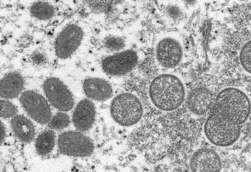 Imagem de microscópio mostra vírus causador da varíola do macaco — Foto: Cynthia S. Goldsmith, Russell Regner/CDC via AP